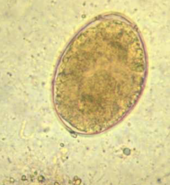 <p><strong>Zdjęcie jaja <em>Diphyllobothrium latum</em> – dopasowanie żywiciela pośredniego</strong></p>