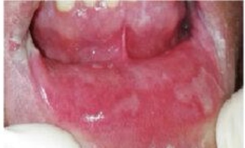 <p>CHẨN ĐOÁN?</p>