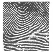<p>Which major ridge pattern is this?</p>