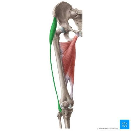 <p>What Muscle is this, and what is it origin and insertion points?</p>