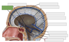<p>This is the</p>