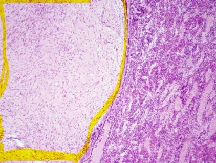 <p>what is the highlighted part </p>