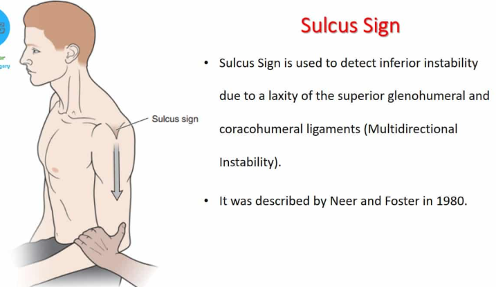 <p>Let the arm hang relaxed at your side. Someone pulls it straight down. If a small gap or dip appears at the top of the shoulder, it’s positive.</p><p>glenohumeral insablity (shoulder subluxation/dislocation histroy)</p>