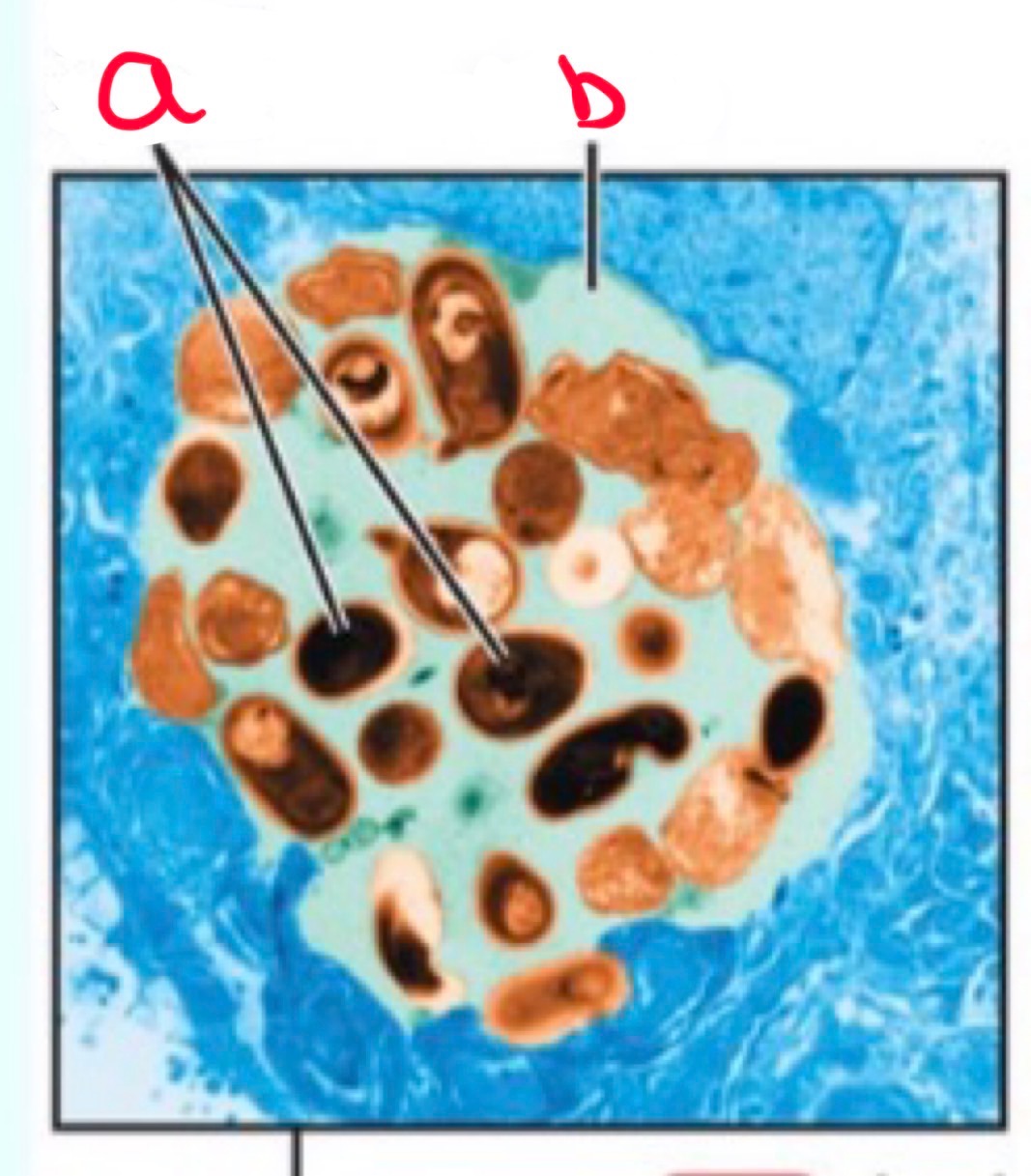 <p>What is this? label it and explain its life cycle when ingested</p>