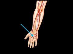 <p>Palm</p>