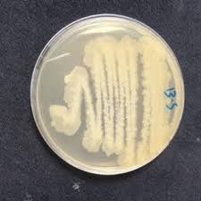 <p>On standard nutrient agar, colonies appear large opaque, and creamy to grayish-white. They often have an irregular or undulate margin with a rough, wrinkled, or dull surface (resembling frosted glass). Soil isolates can display a "swarming" spreading growth across the plate</p>