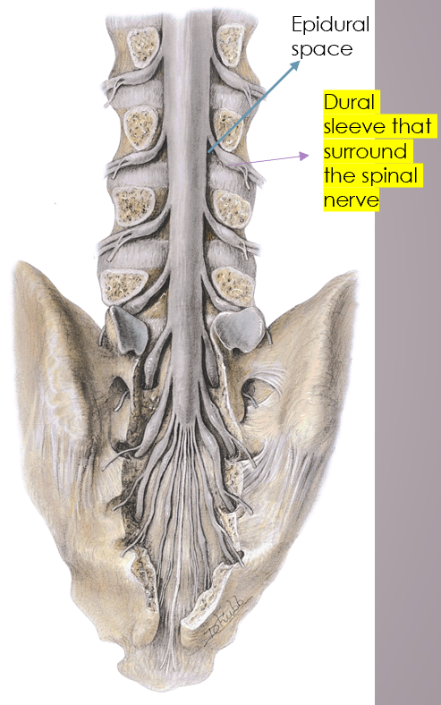 <p>extends out around spinal nerves as they exit, then dura blends with epineurium of nerve</p>