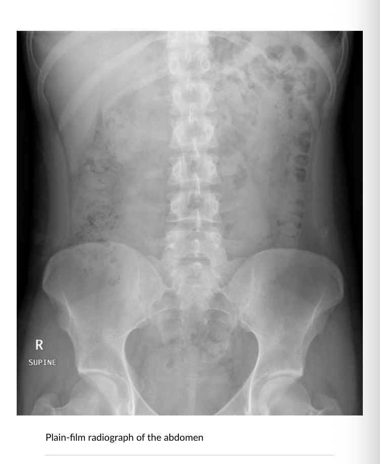 <p>Air: Black (least dense) Bone: Bright White Soft Tissue: Grey</p>