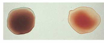 <p>What blood type is this?</p>