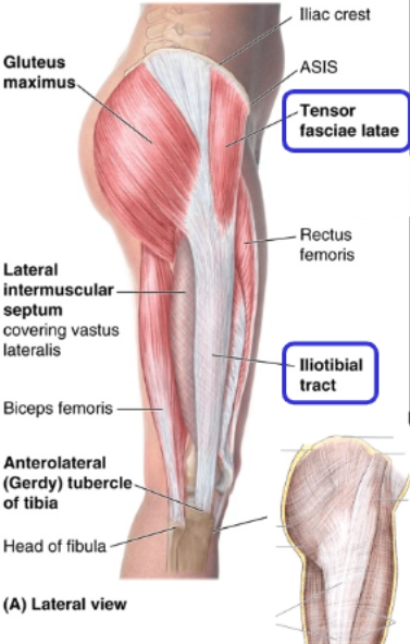 <p>origin: anterior superior iliac spine and iliac crest</p><p>insertion: iliotibial tract</p>