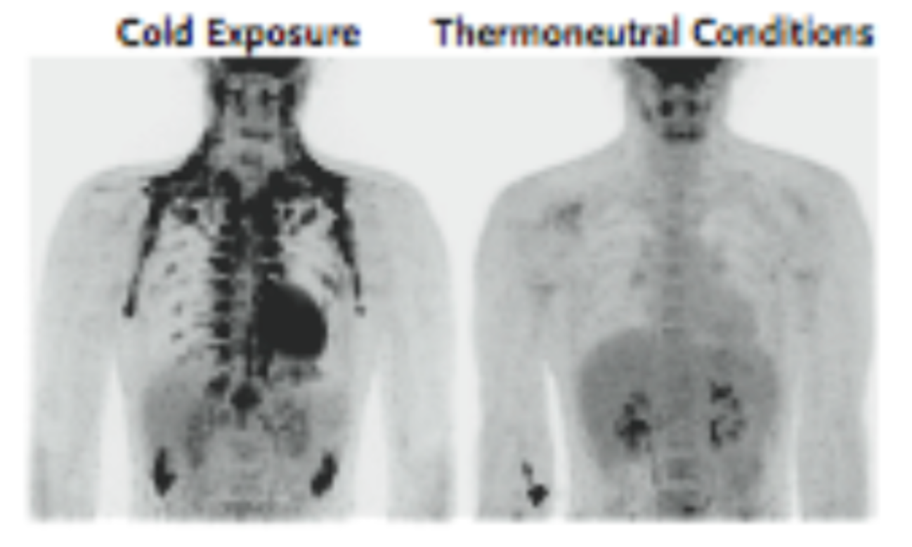 <p>Brown fat quantities increase with persistent cold exposure and are sharply reduced in obese individuals.</p>