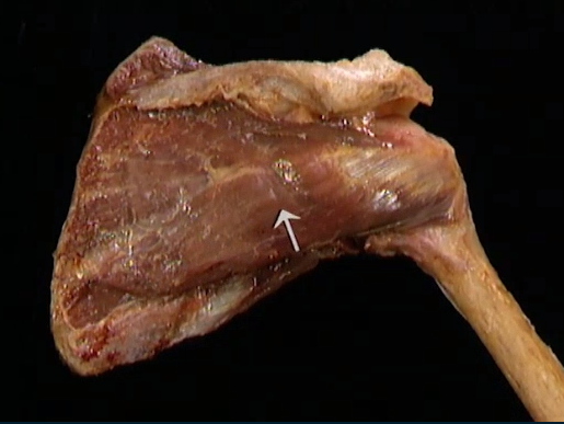 <p>Oppervlakkig, schouder</p>