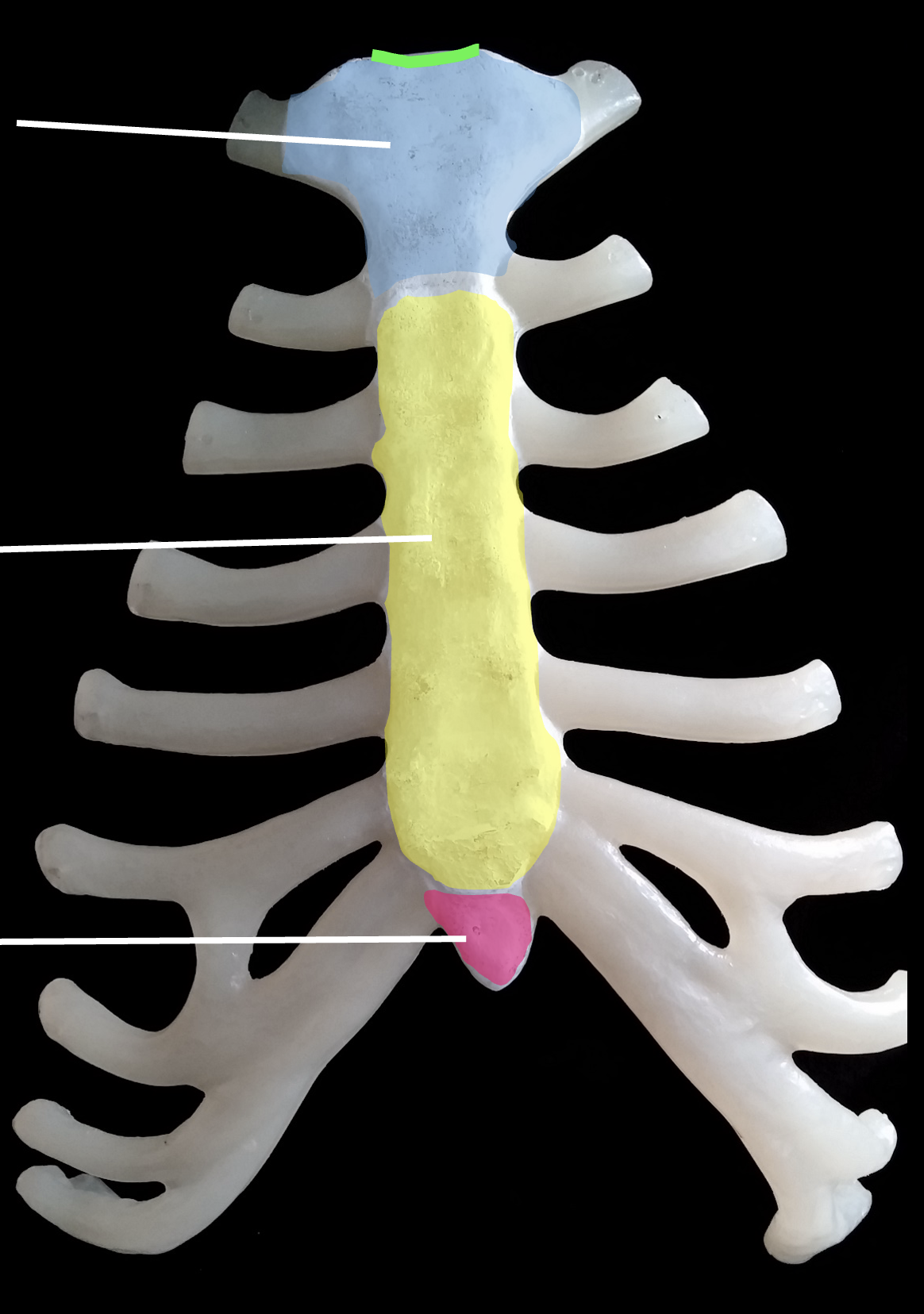 <p>What is the green region highlighted on the sternum?</p>
