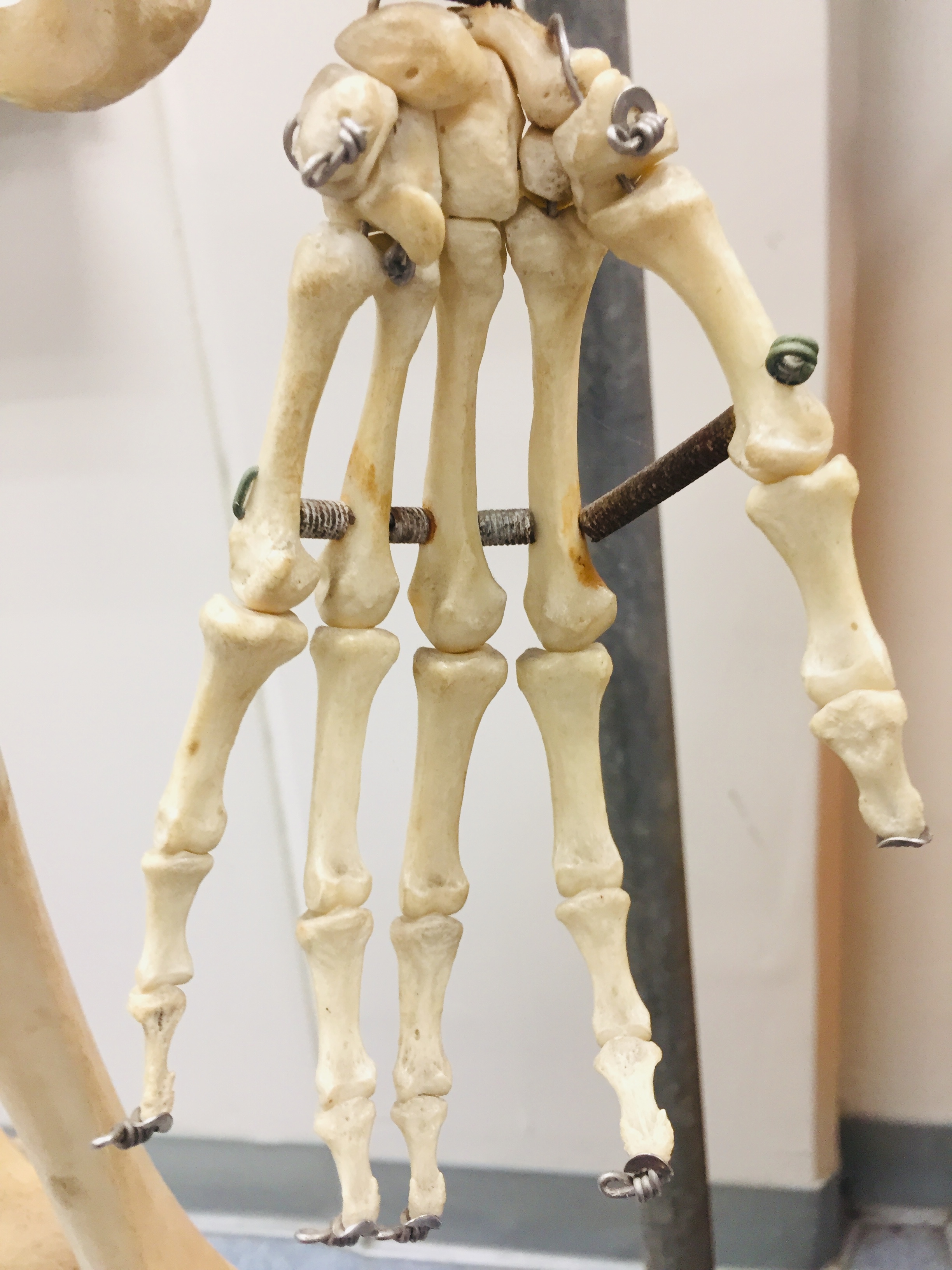 <p>carpal bones, metacarpal bones, phalanges</p>