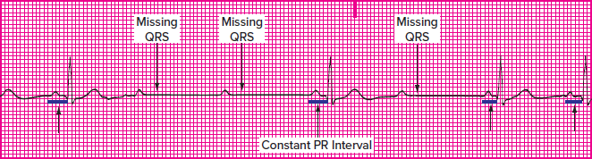 <p>Which rhythm is this?</p>