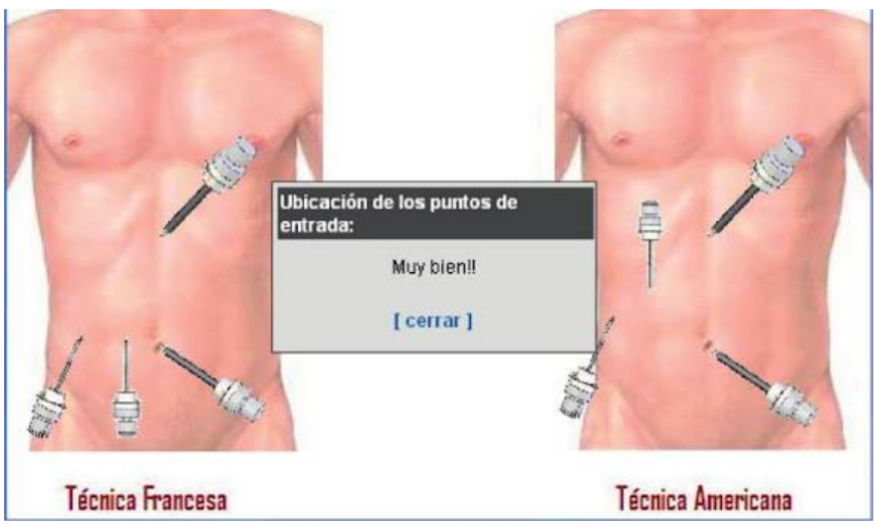 <p style="text-align: justify;"><span style="background-color: transparent;">¿Qué escuela respalda la siguiente técnica quirúrgica laparoscópica?</span></p>