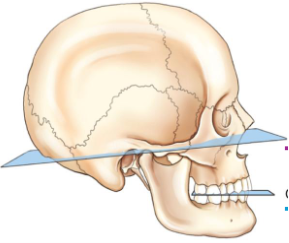 <p>precise transverse plane that connects lines from infraorbital margins to superior margin of external auditory meatus EAM</p>