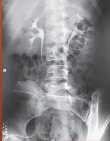 <p>what is this a projection of</p>