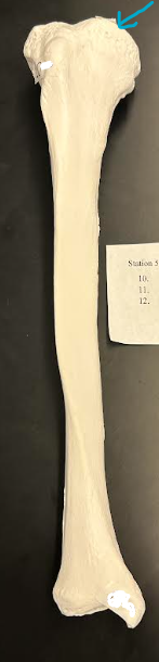 <p>ID tibia structure </p>