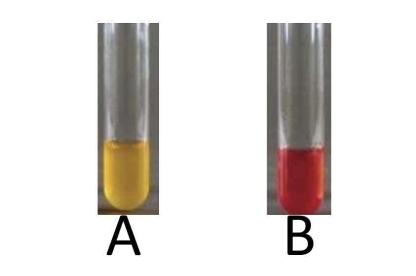 <p>Methyl Red Test</p><p>a) Medium?</p><p>b) Substrate?</p><p>c) Enzyme?</p><p>d) Indicator/Reagent?</p><p>e) End Product?</p>
