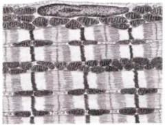 <p>Is this type I or II muscle fibers?</p>