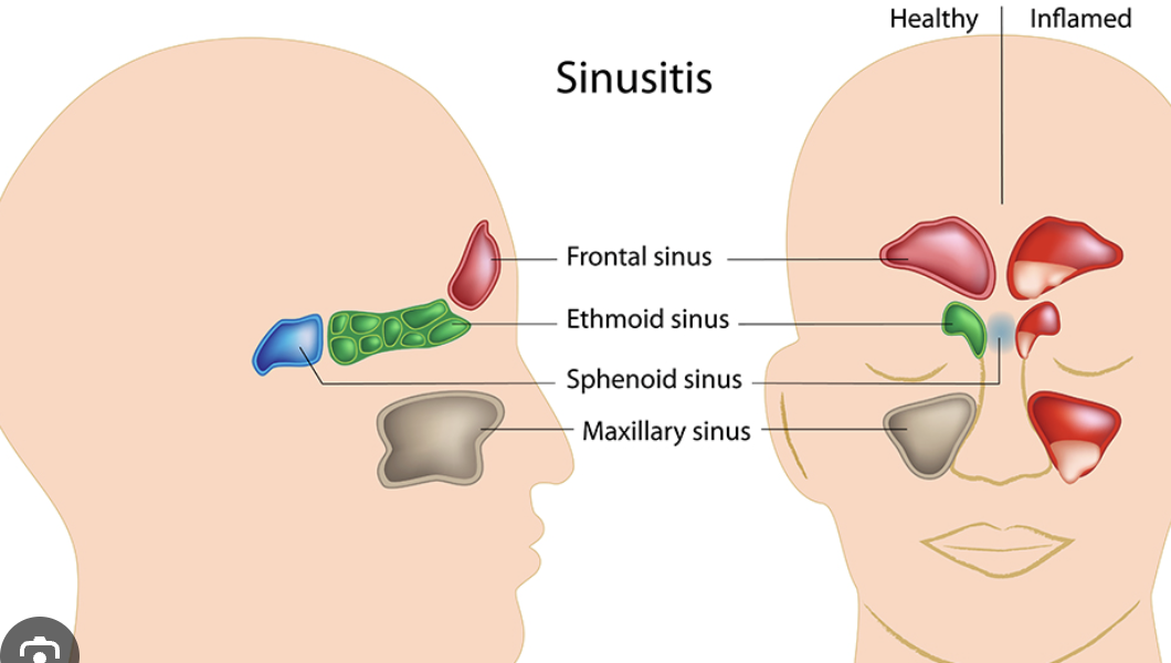 <p>Identify the sinus in green</p>