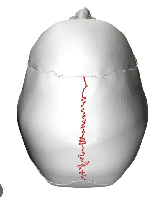 <p>Welk sutuur is dit?</p>