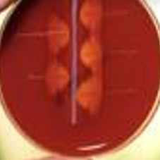 <p>Streptococcus agalactiae produceert een CAMP-factor dat de werking van het bèta-hemolysine van Staphyloccus aureus versterkt </p><ul><li><p>Schapenbloedagar → streepenting met Staphylococcus aureus</p></li><li><p>Loodrecht hierop → streepenting met staal dat vermoedelijk Streptococcus agalactiae bevat (strepen mogen elkaar niet raken) </p></li><li><p>Verhoogde CO<sub>2</sub>-incubatie 18-24 uur</p></li><li><p>Driehoekige zone van versterkte bèta-hemolyse met de punt naar de entingslijn van de stafylokok gericht (versterken elkaars hemolyse)</p></li></ul><p></p>