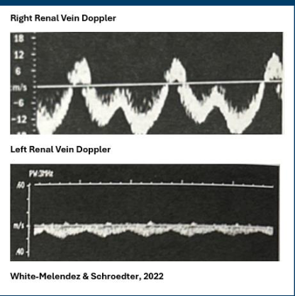 <p>is this a normal finding?</p>