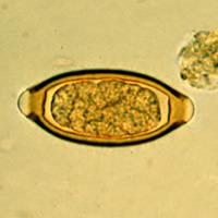 <p>Mucus plug</p>