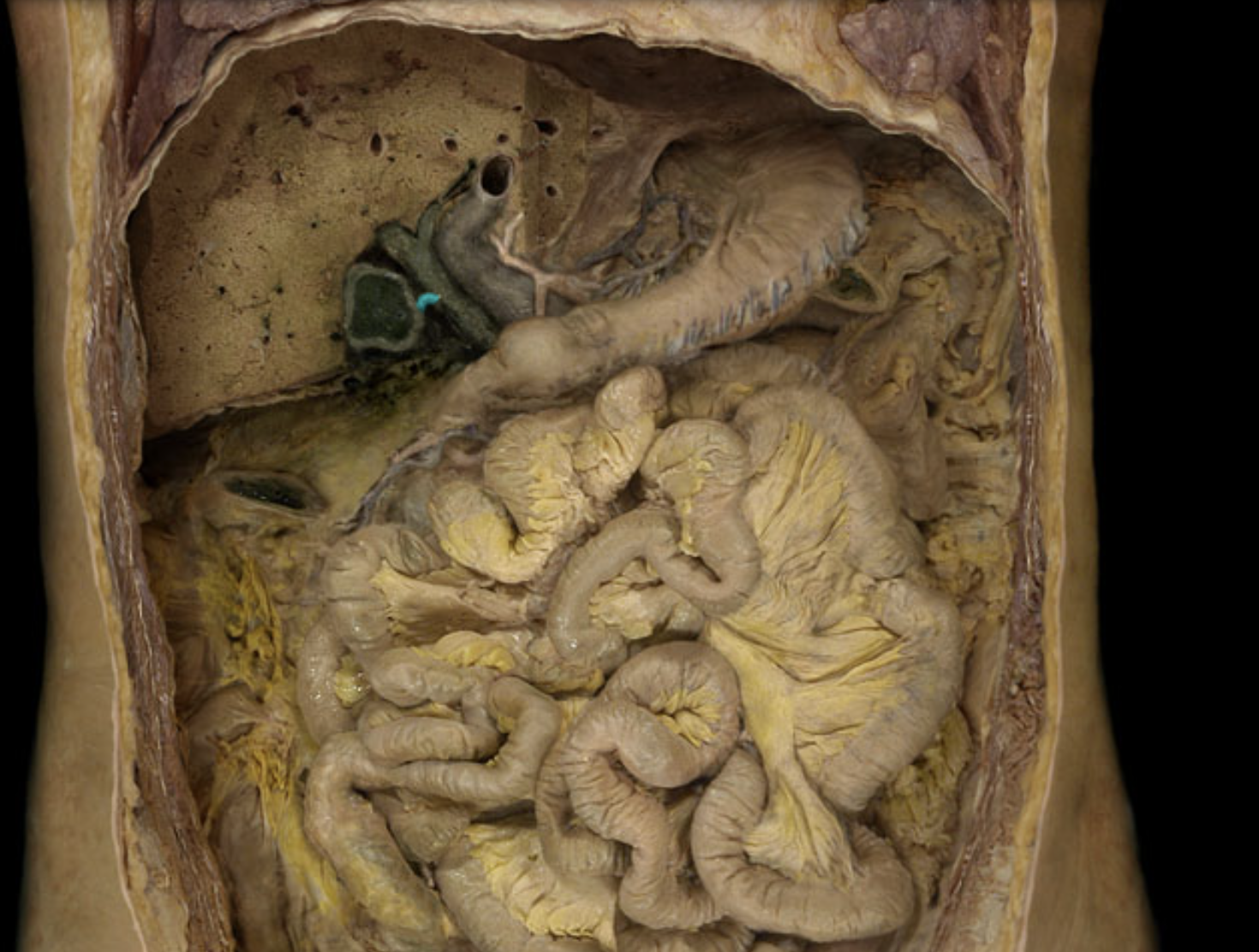 term image