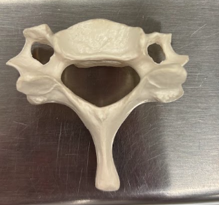 <p>What kind of vertebrae is this?</p>