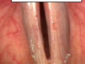 <p>what? (shows at close)</p>