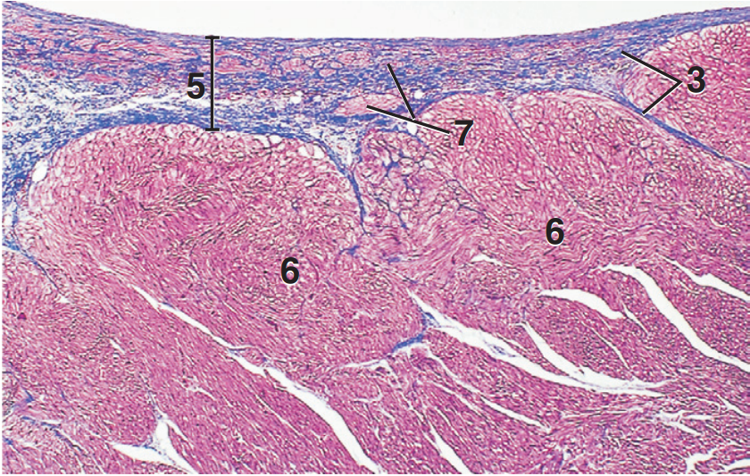 <p>Part and stain?</p>