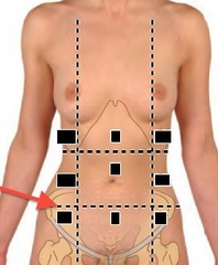 <p>inferior horizontal line</p>