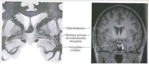 <p><span>OB projects to the corticomedial nucleus of the amygdala (it has three parts, others being basolateral &amp; central). Odor perception &amp; discrimination. Also projects to hypothalamus to regulate food intake. Create odorant memories and smells can evoke memories.</span></p>