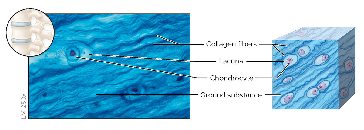 <p>Fibrocartilage</p>