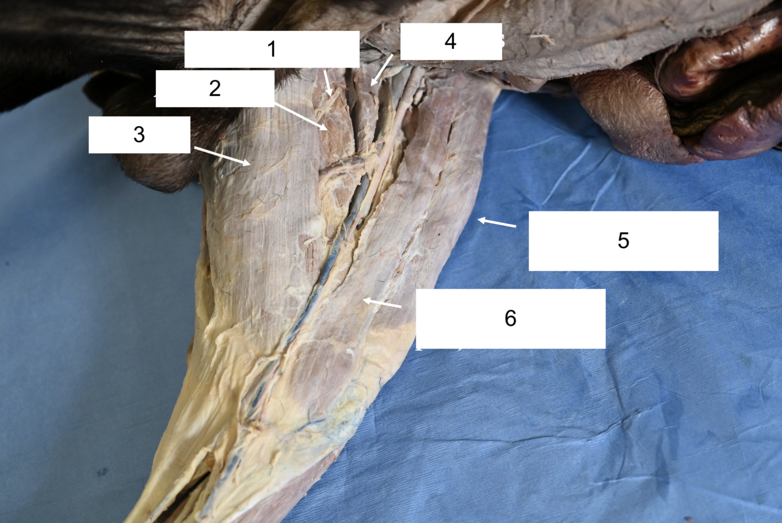 <p>What is 2?</p>