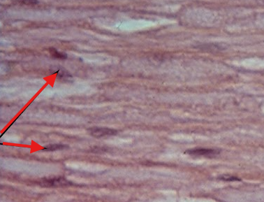 <p>nerve ( longitudinal Section 400x )</p>