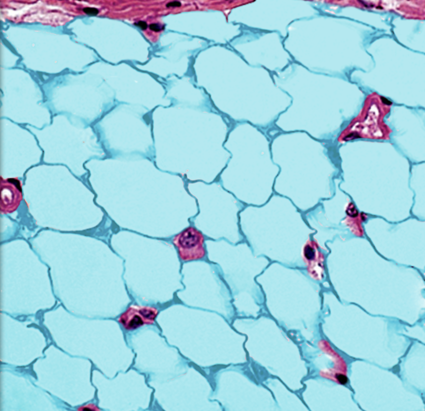 <p>Adipocyte </p>