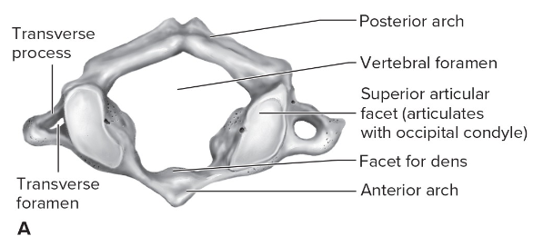 <p>(first cervical vertebra), superior view</p>