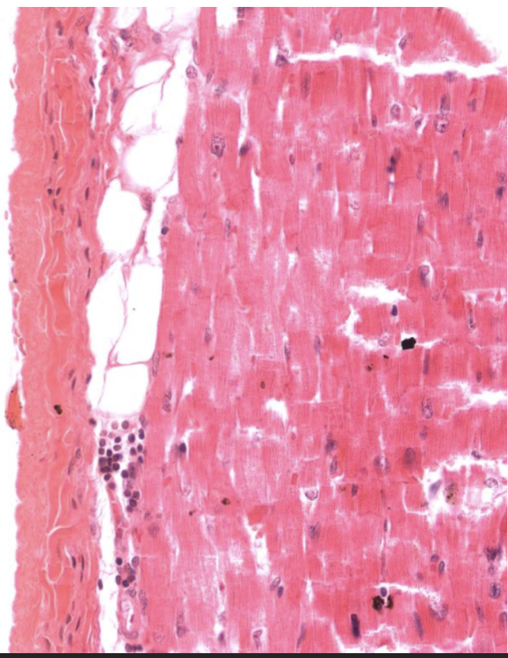 <p>Identify Which partition this is and Where?</p>