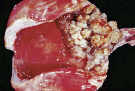 <p>Image of the bladder of a dog. What is the likely cause?</p>