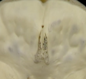 <p>what is the “crest” and surrounding</p>