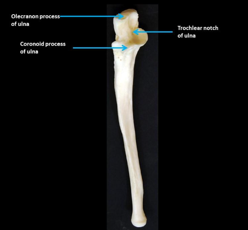 <p>anterior ulna</p>