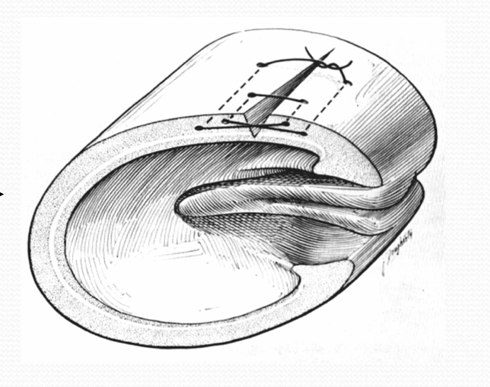 term image