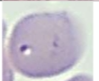 <p>RBC Paraasite</p>