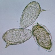<p>Identify the organism</p>