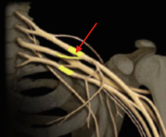 <p>Identify the structure</p>