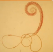 <p>what nematode is this?</p>